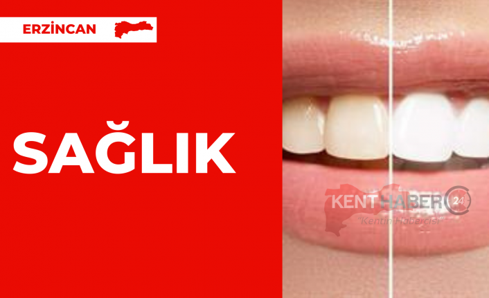 Gülümsemek bulaşıcıdır ve hepimiz parlak, kendine güvenen bir gülümsemeye sahip