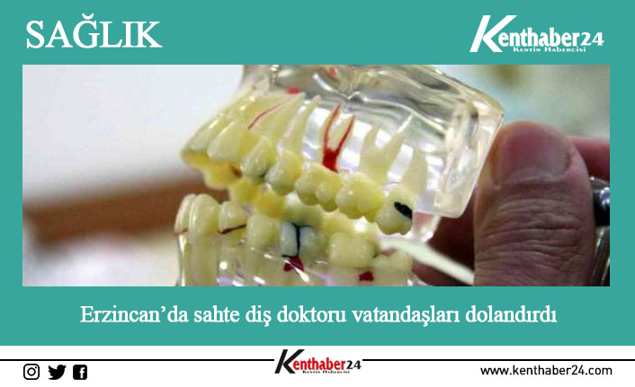 Erzincan’da sahte diş doktoru vatandaşları dolandırdı Erzincan’ın Çayırlı ilçesinde kendini diş hekimi olarak tanıtan ve protez