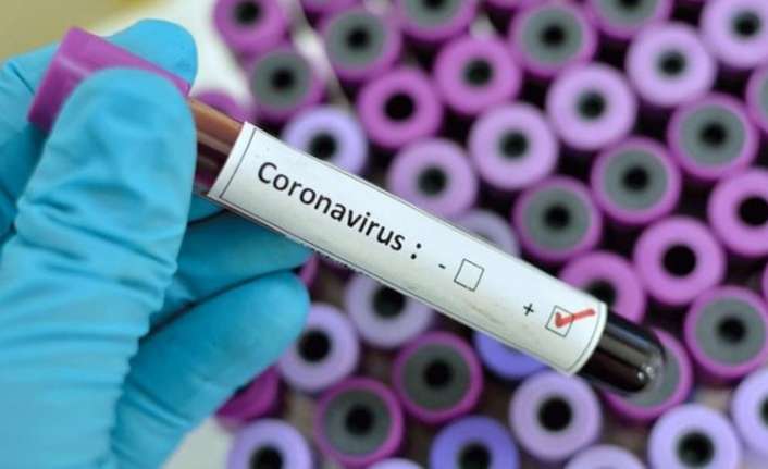 Erzincan’da korona virüs testi
