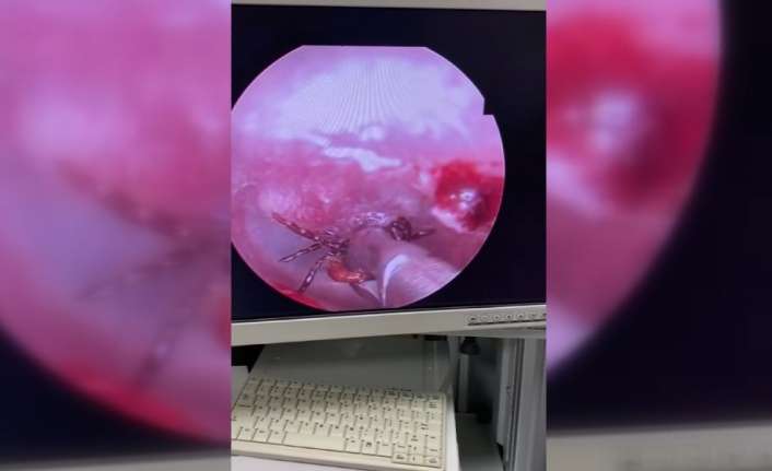 ERZİNCAN’DA HAVALARIN ISINMASIYLA BİRLİKTE KENELERDEN İNSANLARA GEÇEN KIRIM KONGO KANAMALI
