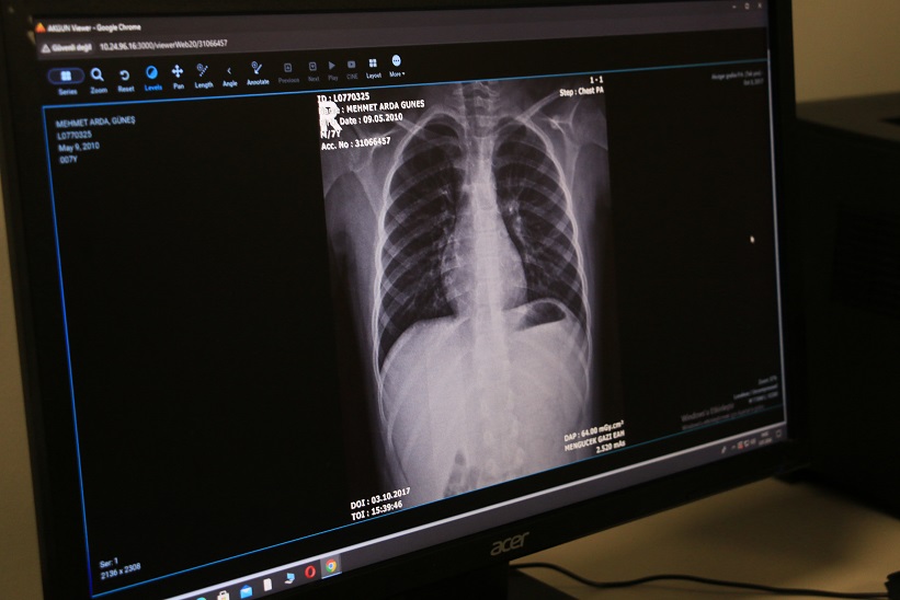 1-30 Kasım Akciğer Kanseri Farkındalık Ayı dolayısıyla Erzincan İl Sağlık