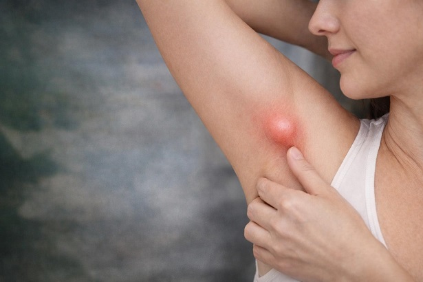 Prof. Dr. Ahmet Karacalar, koltuk altında görülen bazı şişliklerin basit